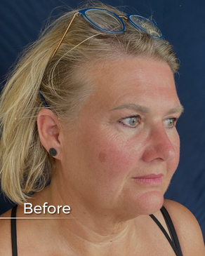 Slider image (3) Boroyan Plastic Surgery in Yerevan Armenia